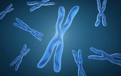 La sindrome della X Fragile
