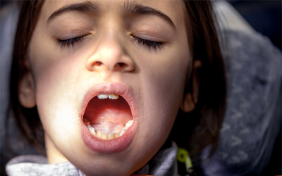 Le paure più comuni legate al dentista e le soluzioni del dipartimento di odontoiatria di Istituto Santa Chiara