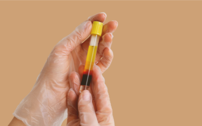 PRP Lecce: Plasma Ricco di Piastrine