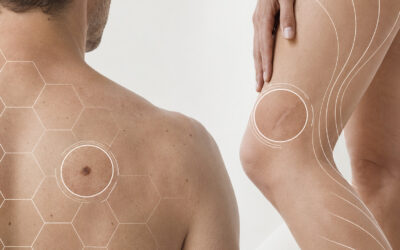 Dermatologo o chirurgo plastico? Quando rivolgersi a uno o all’altro